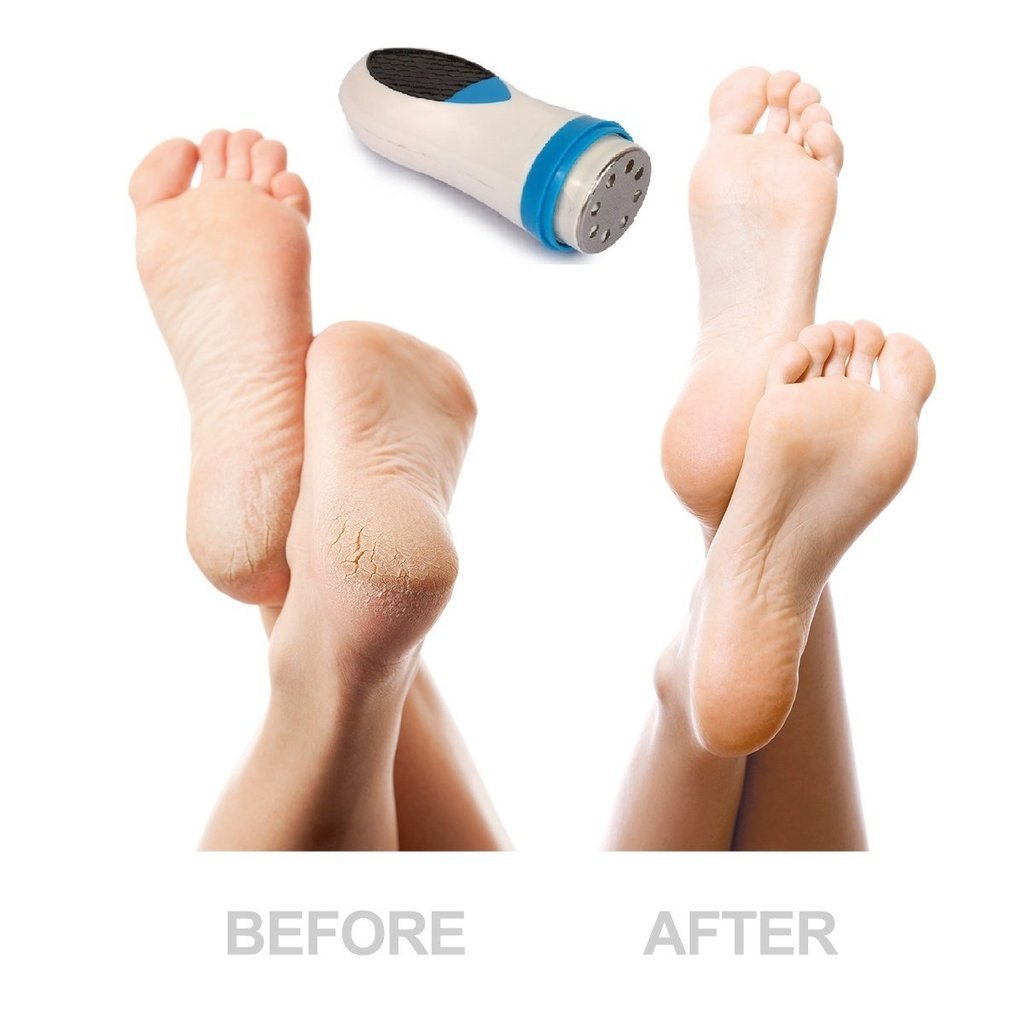 Gadgets d'Eve beauté SILSPIN™ : Pédicure magique pour les pieds.