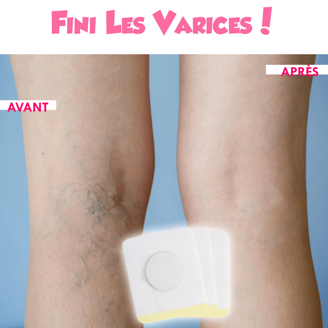 Gadgets d'Eve Santé VAPATCH™ : Patchs anti-Varices (40 Pièces)