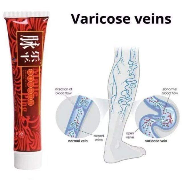 Gadgets d'Eve Santé VARIXON™ : Crème Magique Anti-Varices